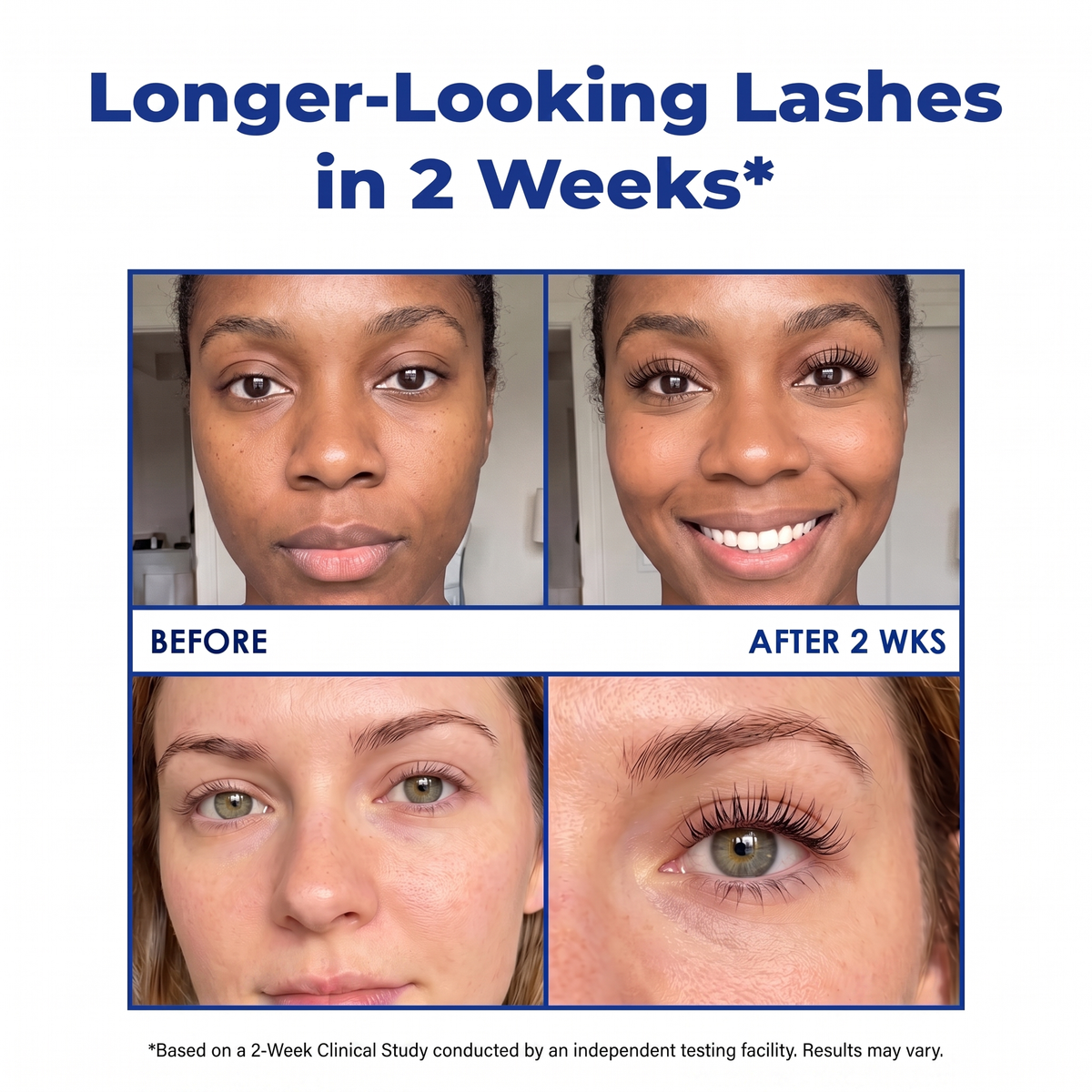 Harrigarri Eyelash Essential Serum – Longer, Fuller & Stronger-Looking Lashes