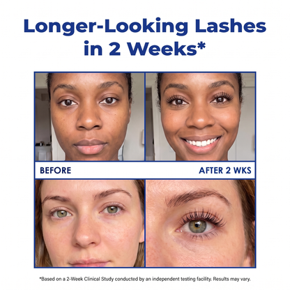 Harrigarri Eyelash Essential Serum – Longer, Fuller & Stronger-Looking Lashes